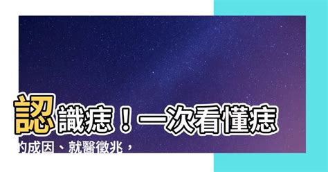 身體痣|痣是什麼？一次了解痣原因、就醫時機以及如何改善